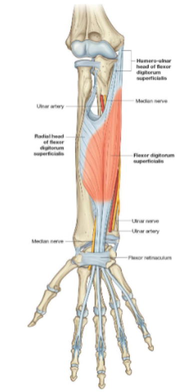 <p>Origin: humero-ulnar head- medial epicondyle + coronoid process of ulna</p>