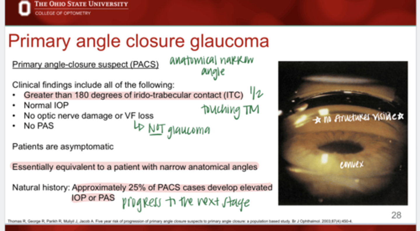 <p>Clinical findings in a patient that is a Primary angle closure suspect?</p>