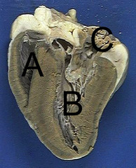 <p>What is B?</p>