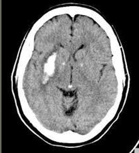 <p>diagnosis</p>