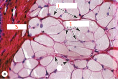 <p>What is labeled 1?</p>