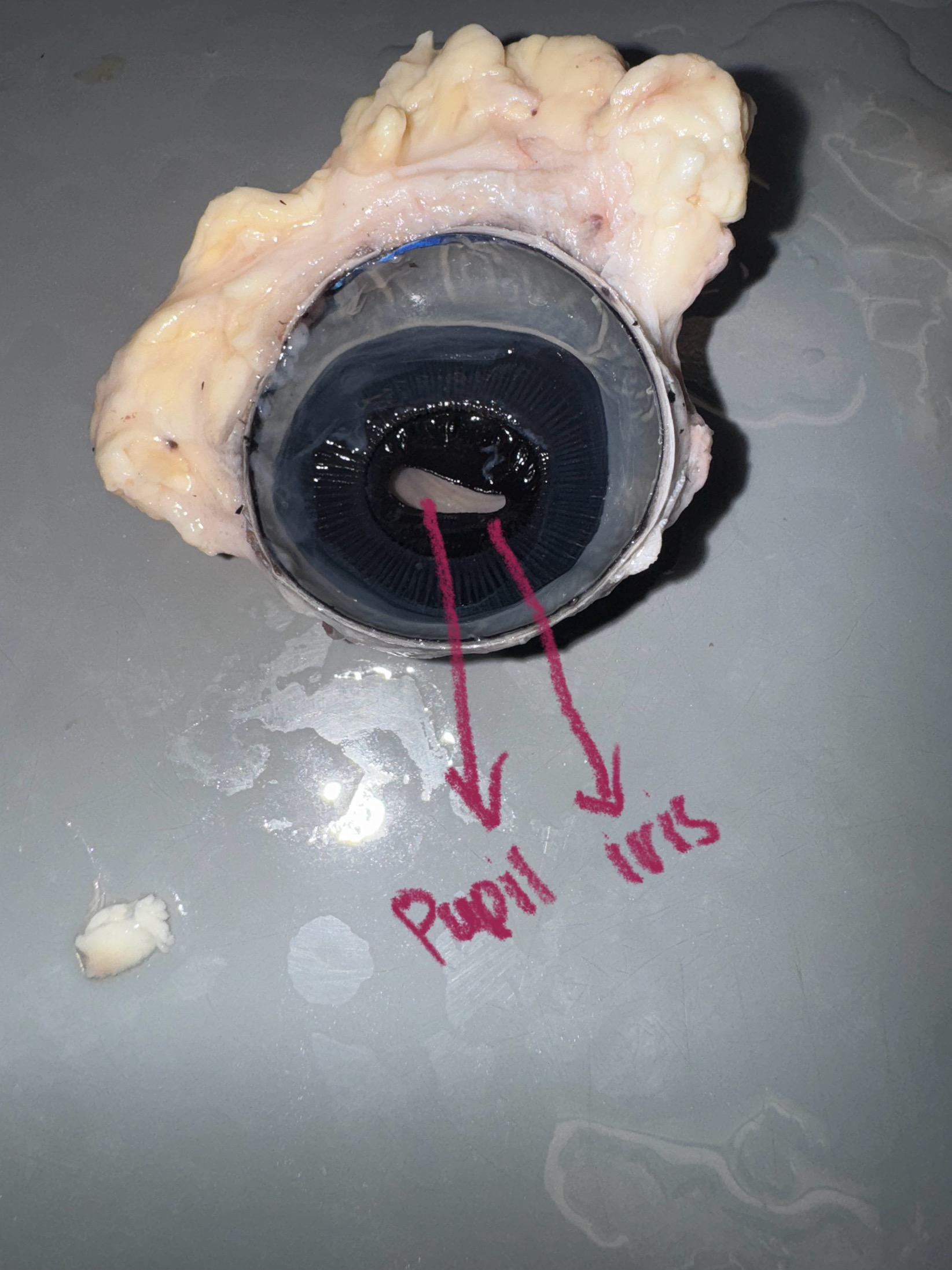 <p>Identify: </p><p>-Pupil </p><p>-Iris </p><p>-Lens </p><p></p>