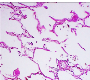 <p>ID this condition and its identifitying features</p>