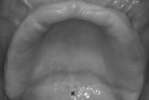 <p>K</p>