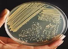 <ul><li><p><span>On general media, colonies are small (1–2 mm in diameter), circular, convex, smooth, and glistening.</span></p></li><li><p><span><strong>Pigmentation:</strong> Colonies are typically non-pigmented, appearing white, grey, or beige (distinguishing it from the golden-yellow colonies of <em>S. aureus</em>).</span></p></li></ul><p></p>