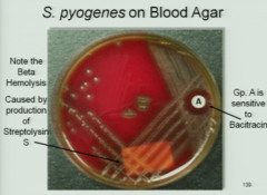<p>Zone of inhibition around bacitracin disk</p>