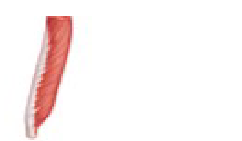 <p>Extensor digitorum longus - what pattern</p>