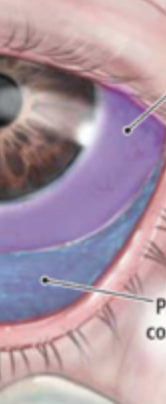 <p>Bulbar</p><p>Palpebral </p>