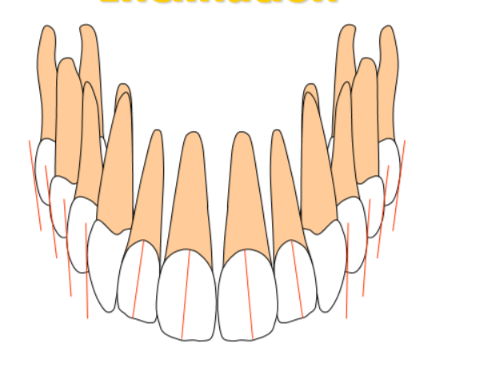 <p>crown and root position relationship</p><p>applies mainly to anterioir teeth</p><p>crown is slightly more labial than root in anterioir teeth</p><p>posterior segment - root is not more buccal than crown - root is not more buccal than crown</p>