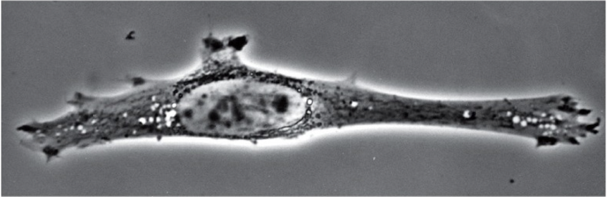 <p>Phase Contrast microscopy</p>
