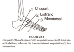 <p>dysvascularity </p>