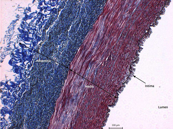 <p>What does the blue, red and white represent in this image</p>