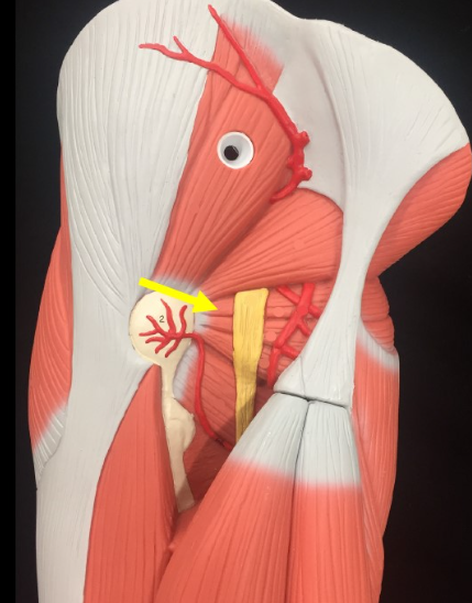 <p>Name the muscle</p>