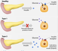 <p>What is diabetes?</p>