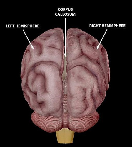 <p>It connects the left and right hemispheres of the brain</p>
