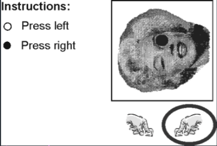 <p><span style="line-height: 22.0875px;">• A black or white dot was presented on the left or right eye of a human face rotated by 90.&nbsp;</span></p><p class="Paragraph SCXW77519165 BCX0" style="text-align: left;"><span style="line-height: 22.0875px;">• Participants were instructed to press the left key when the white dot was presented and the right key for a black dot.&nbsp;&nbsp;</span></p><p class="Paragraph SCXW77519165 BCX0" style="text-align: left;"><span style="line-height: 22.0875px;">• The circle indicates the correct response.&nbsp;</span></p><p class="Paragraph SCXW77519165 BCX0" style="text-align: left;"><span style="line-height: 22.0875px;">Results:&nbsp;&nbsp;</span></p><ul><li><p class="Paragraph SCXW77519165 BCX0" style="text-align: left;"><span style="line-height: 22.0875px;">Participants coded the dots as left and right (e.g., press right was faster when&nbsp;</span></p></li></ul><p class="Paragraph SCXW77519165 BCX0" style="text-align: left;"><span style="line-height: 22.0875px;">the black dot was on the right eye than on the left eye).&nbsp;</span></p><ul><li><p class="Paragraph SCXW77519165 BCX0" style="text-align: left;"><span style="line-height: 22.0875px;">&nbsp;Participants used the visual context as reference frame (i.e., the face in a natural position)&nbsp;</span></p></li></ul><p></p>