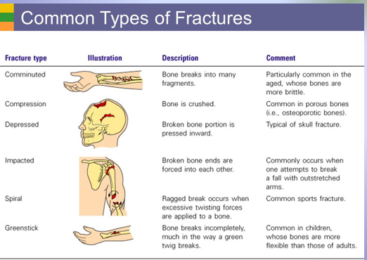 <p>Bone Remodeling Function: Repair of Bone Fractures</p>