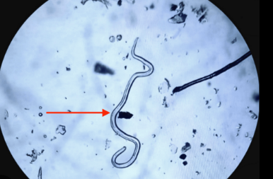 <p>Parasites </p>