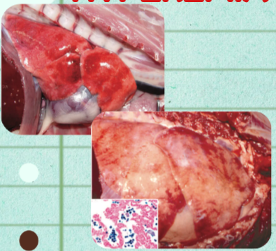 <p>What dual circulatory disturbances of the lung involve an increase in blood volume within the pulmonary vasculature, differentiated primarily by active vs. passive mechanisms?</p>