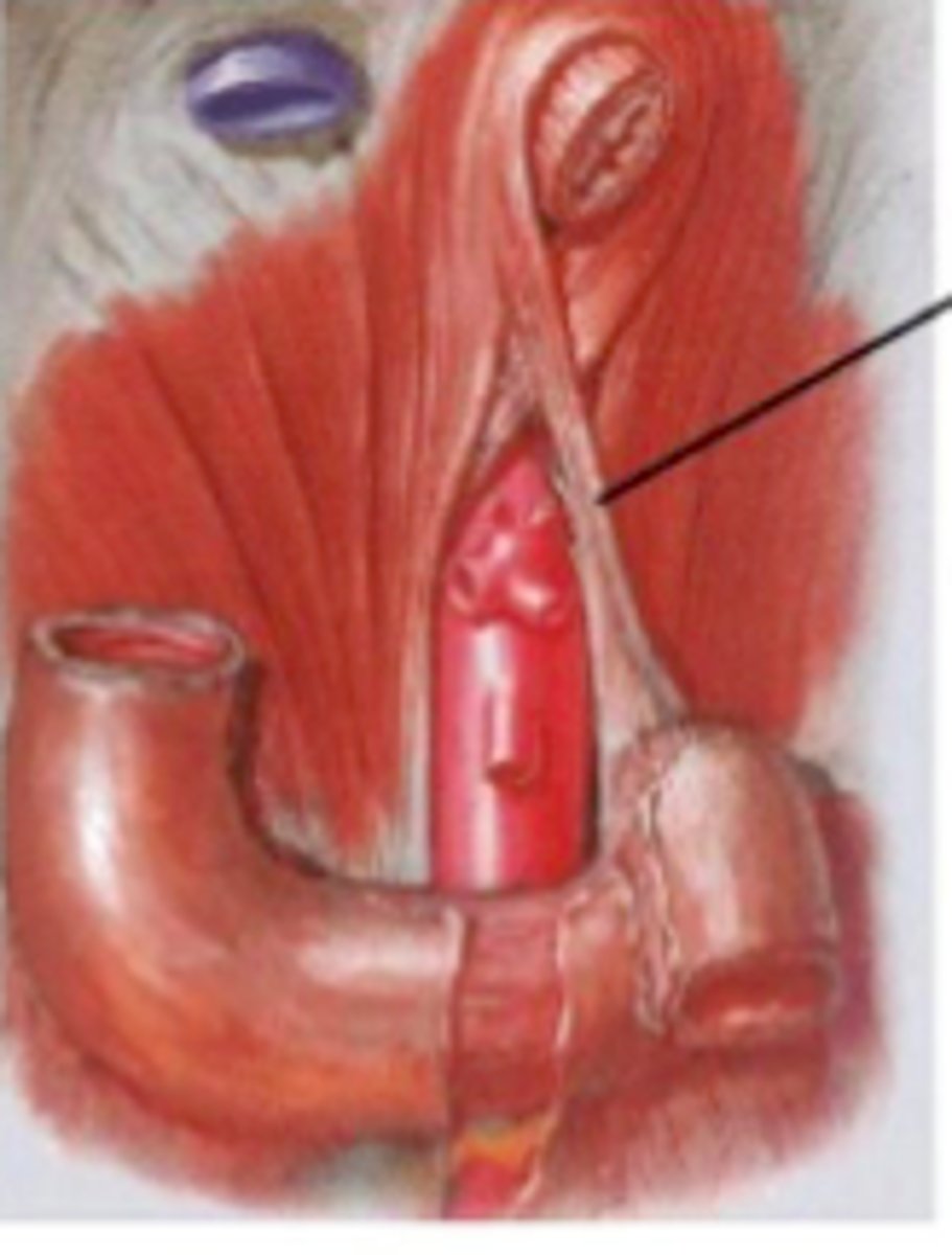 <p>junction associated with duodenum and jejunum - connecting to the diaphragm</p>