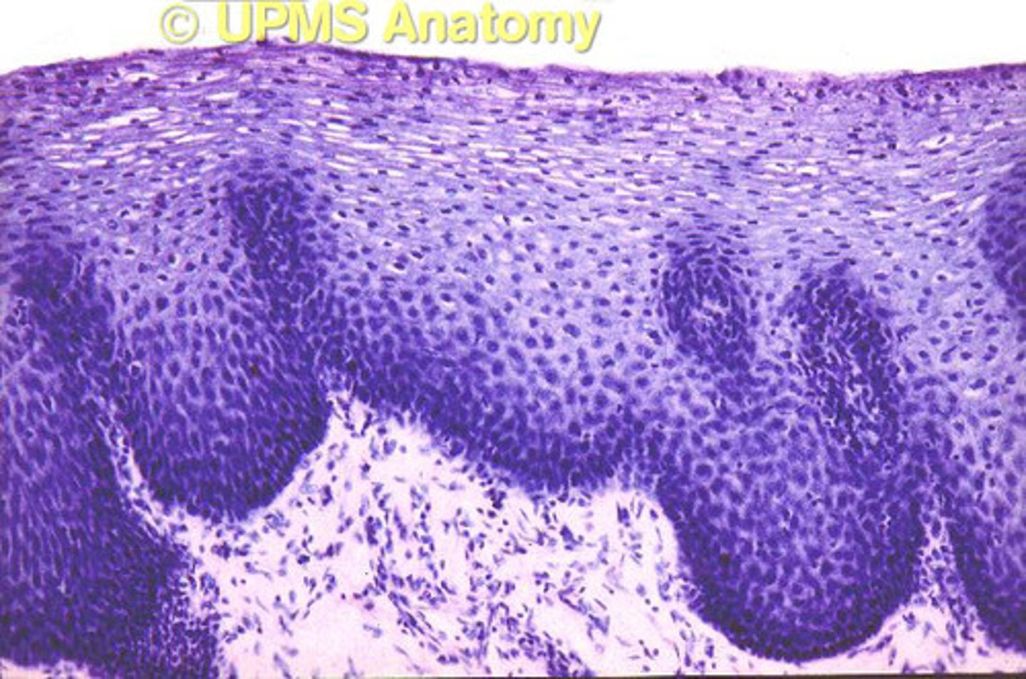 <p>Non-keratinized Stratified Squamous</p>