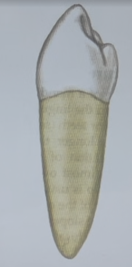 <p>Which premolar is shown in the diagram: maxillary right first premolar, maxillary right second premolar, mandibular right first premolar, mandibular right second premolar</p>