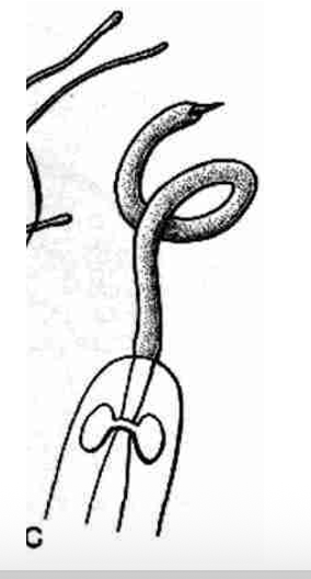 <p><strong>FILO </strong>Nemertea<strong><br>SUBFILO (SUBGRUPO) </strong>Hoplonemertea<br><strong>CARACTERÍSTICAS </strong>Nemertinos con faringe armada, cuerpo no segmentado alargado tipo cinta, probóscide eversible aparte del digestivo.<strong><br>HÁBITAT</strong></p>