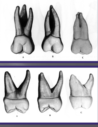 <p>3 roots, MB, DB, and P</p><p>Trifurcated (meaning single root trunk divides into 3 separate roots</p><p>Palatal root is longest, distobuccal is shortest</p><p>Buccal roots incline distally</p><p>MB starts to curve at middle thirds</p>
