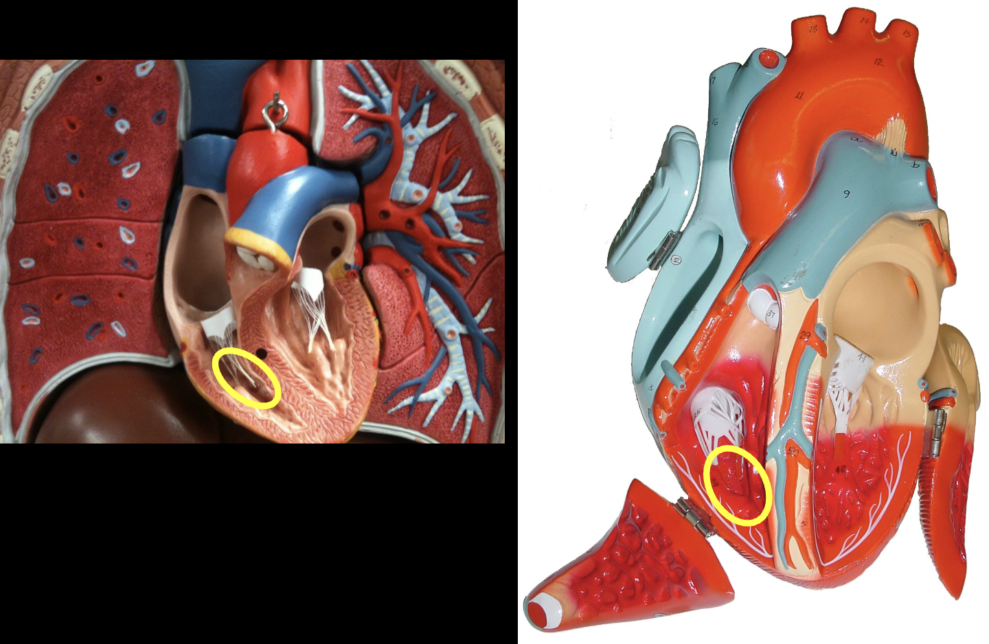 <p>what part of the heart muscle is shown?</p>