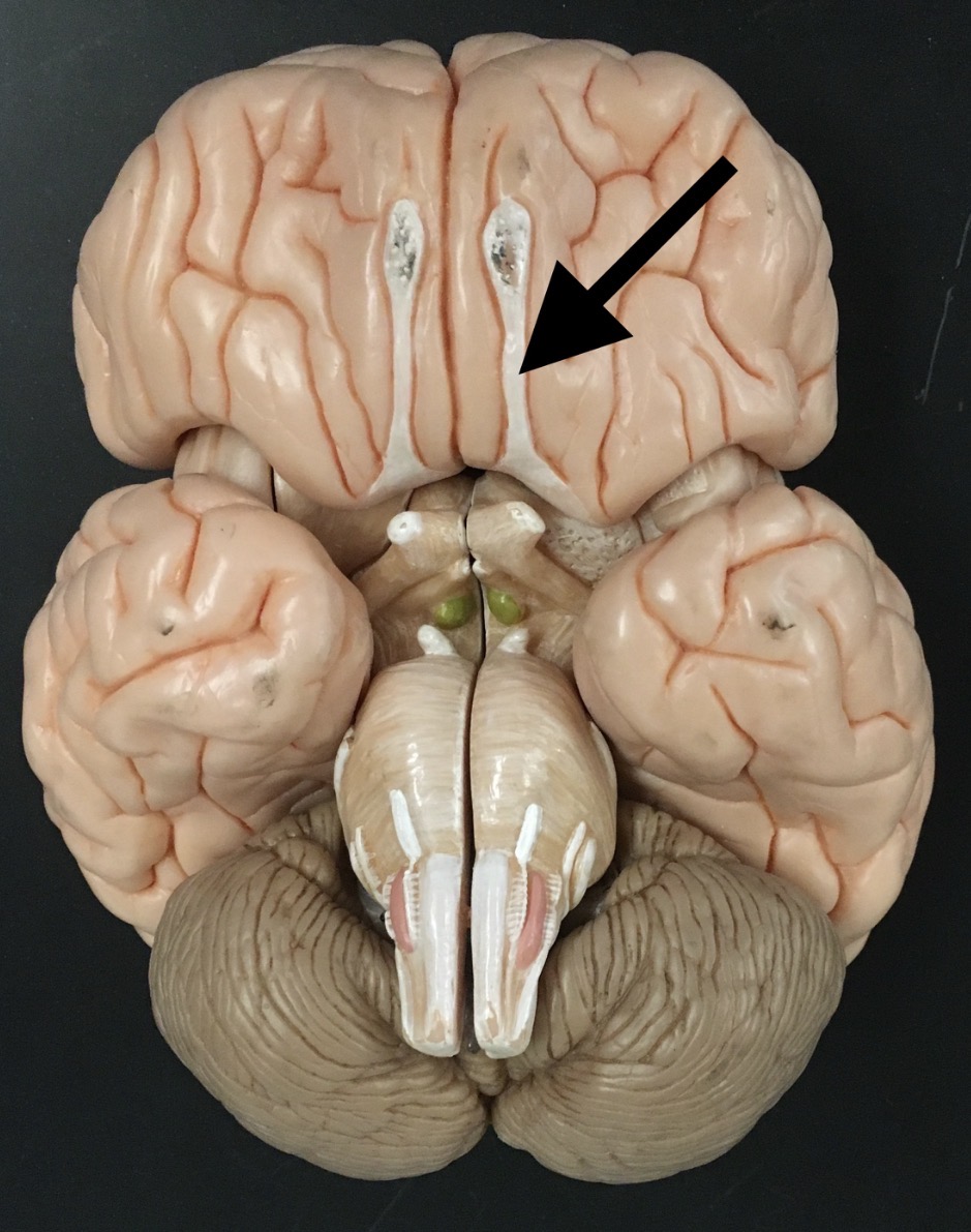 <p>What is the arrow pointing to?</p>