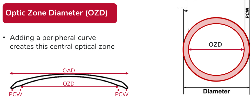 <p>The central optical zone created on the back surface when a peripheral curve is added</p>