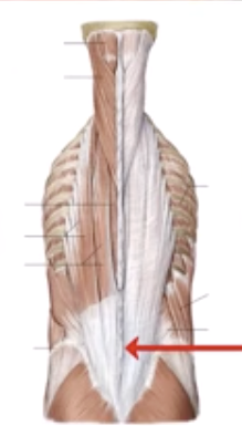 <p>What is the arrow pointing to?</p>