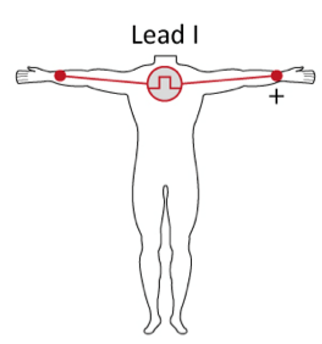 <p>I</p>