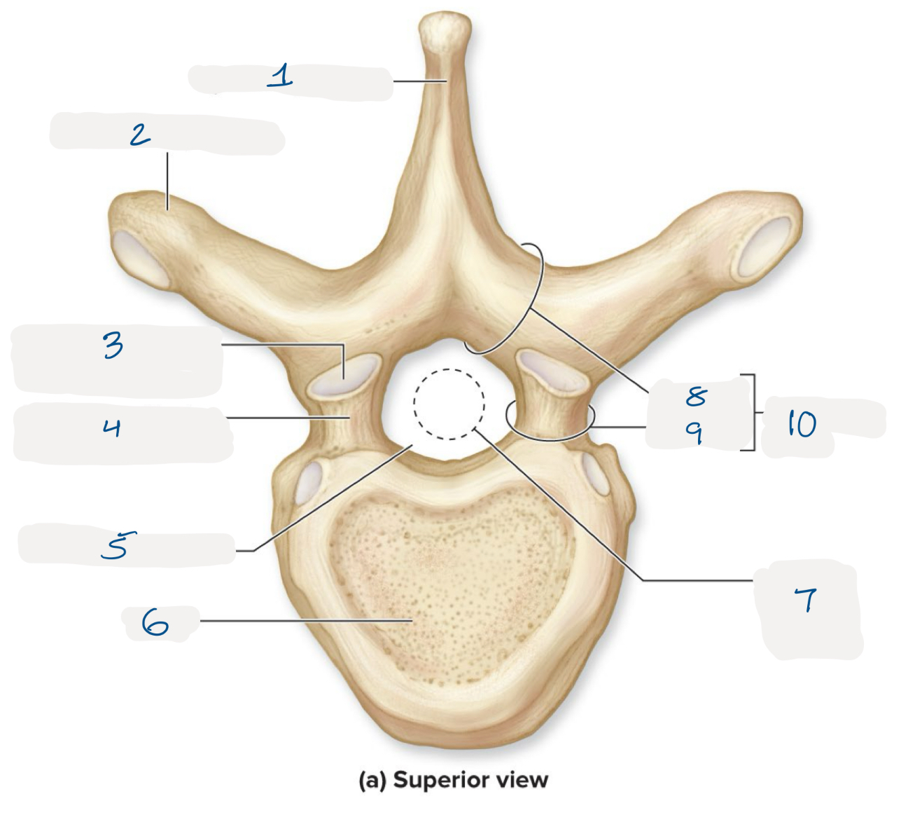 <p>name the numbered regions of the vertebrae</p>
