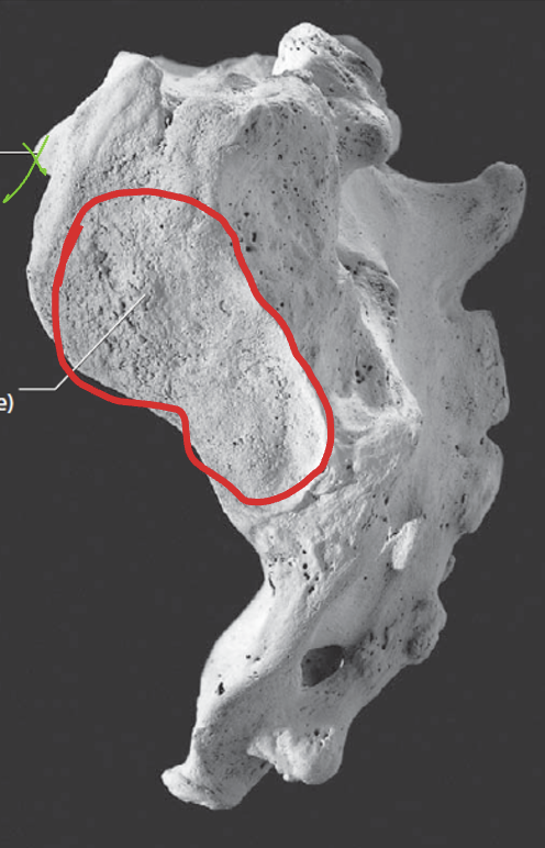 <p>Sacrum: What is the Green?</p>