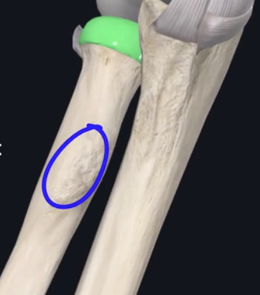 <p>what is this rough boney growth on the radius called?</p>