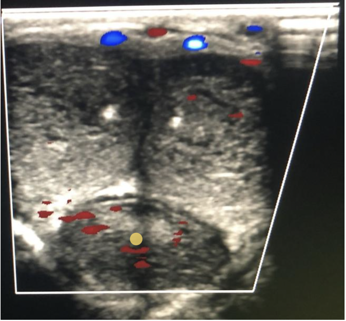 <p>The urethra courses through the center of the corpus spongiosum on the ventral side of the penis.</p>