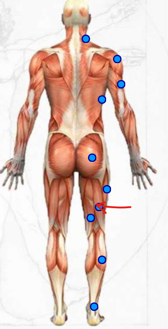 <p>main inner upper leg muscle </p>