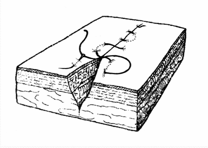 term image