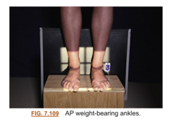<p>kVp: 60-75</p><p>Grid: No</p><p>CR: directed midway between malleoli for AP and Medial malleolus for lateral </p><p>Patient position: both ankles in view, for the lateral do one ankle at a time</p><p>Evaluation criteria: Distal aspect of tibia and fibula demonstrated and Ankle joint to center of collimation field</p>
