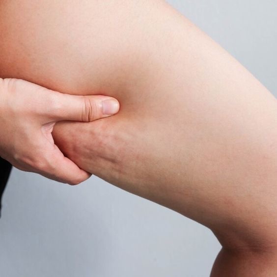 <p>the thigh </p>