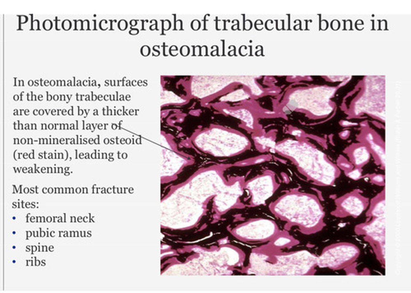 <p>What does the photomicrograph show?</p>