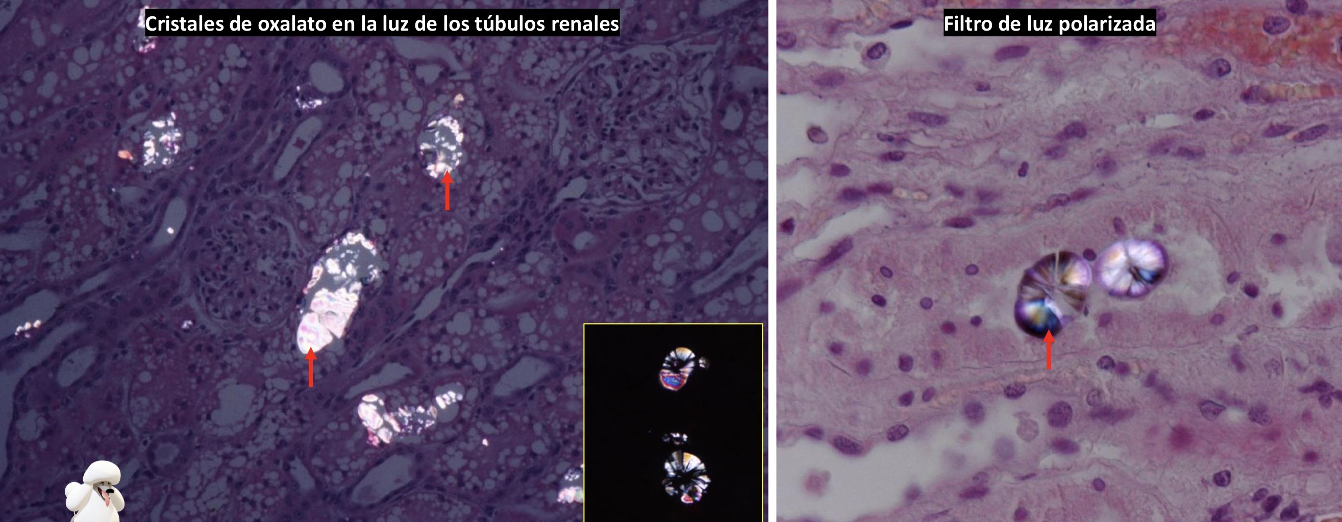 <p>Patogenia </p>