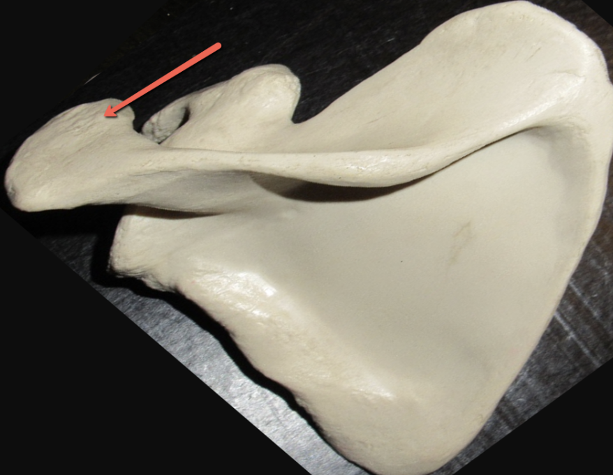 <p><span><strong>Identify the bone marking indicated by the pointer.</strong></span></p>
