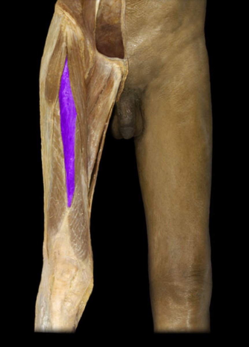 <p>Quadriceps.</p>