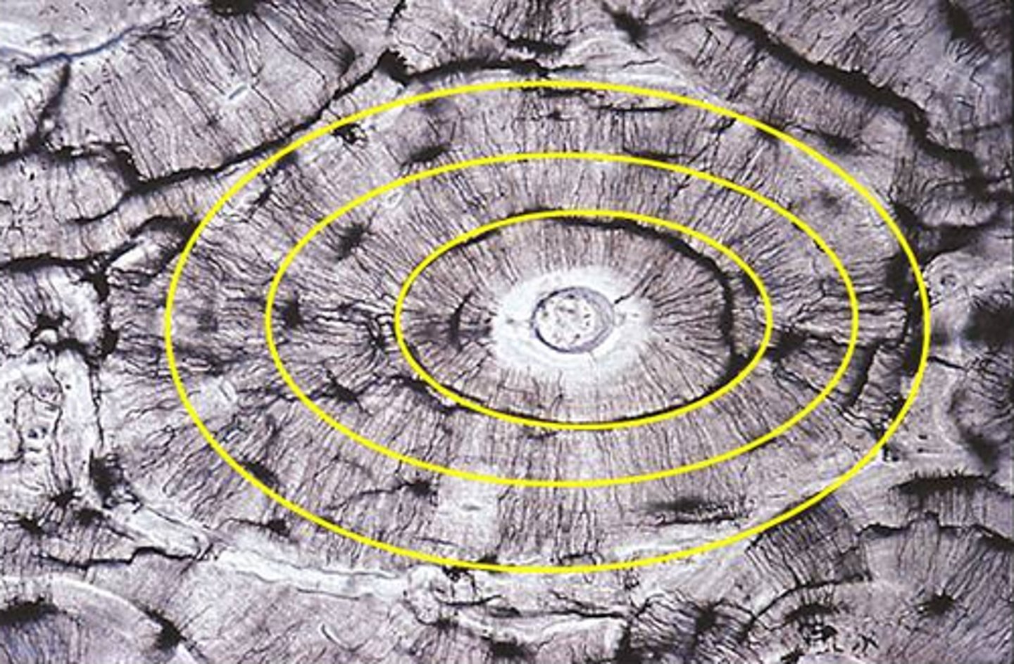 <p>share same center, axis or origin with one inside other</p>