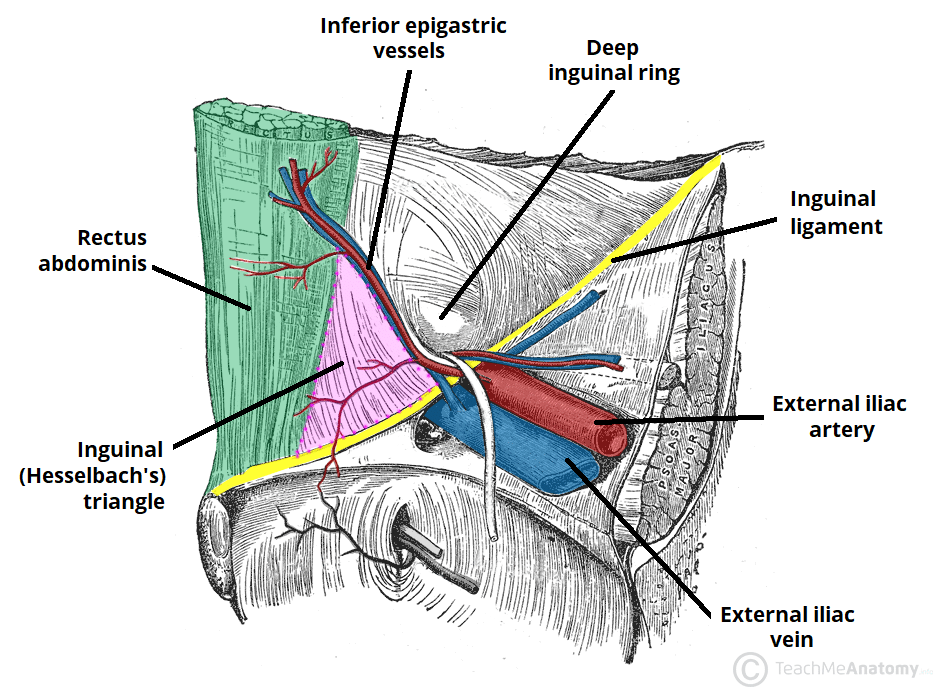 <ul><li><p>Medially: linea semilunaris (lacteral edge of the rectus abdominis)</p></li><li><p>Laterally: Inferior epigastric vessels</p></li><li><p>Inferiorly: The inguinal ligament</p></li></ul><p></p>