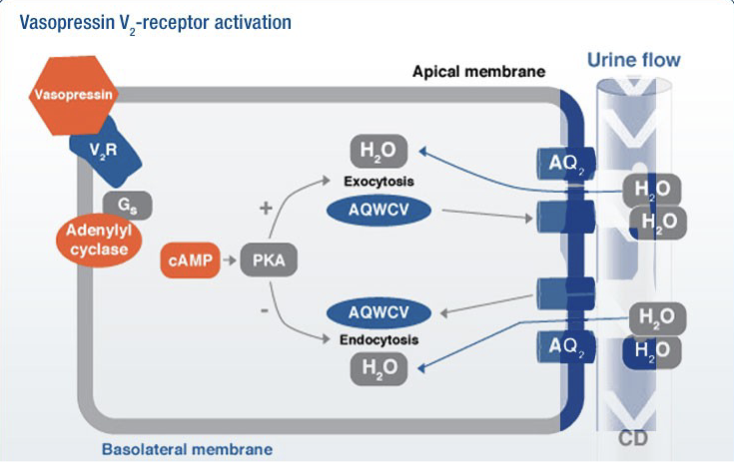 <ul><li><p>ADH binds to V<sub>2</sub> receptors on the basolateral membrane of collecting duct cells which activates a G-protein (G<sub>s</sub>)</p></li><li><p>This activates adenylyl cyclase which converts ATP into cAMP, which then activates protein kinase A (PKA)</p></li><li><p>PKA triggers exocytosis of aquaporin-containing vesicles (AQWCV), inserting aquaporin-2 channels into the apical membrane of the collecting duct (concentrated urine)</p></li><li><p>When ADH is absent, the opposite occurs where aquaporin-2 channels are removed from the membrane by endocytosis (dilute urine)</p></li></ul><p></p>
