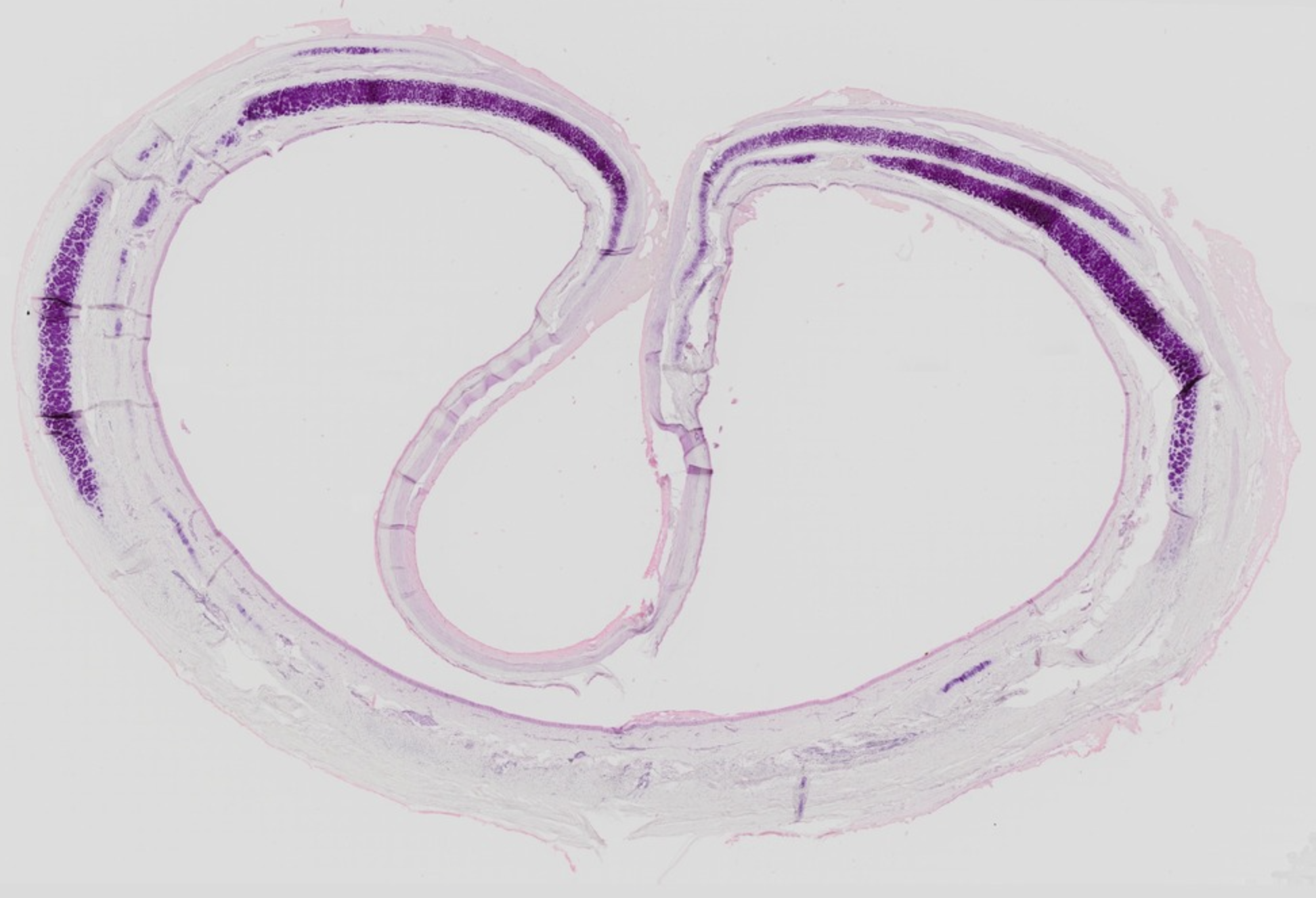 <p>How do you identify trachea in a histological section?</p>