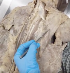 <p>Name the Muscle</p>